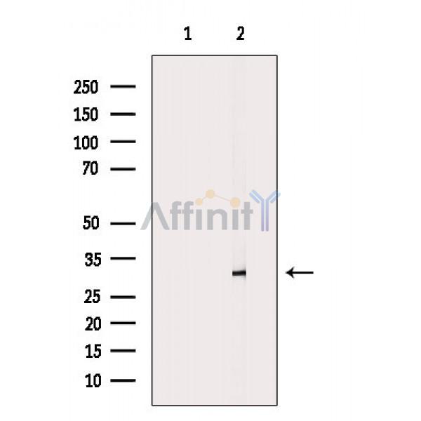 Валидация Affinity DF3194 - 14011