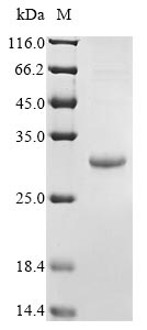 SDS-PAGE