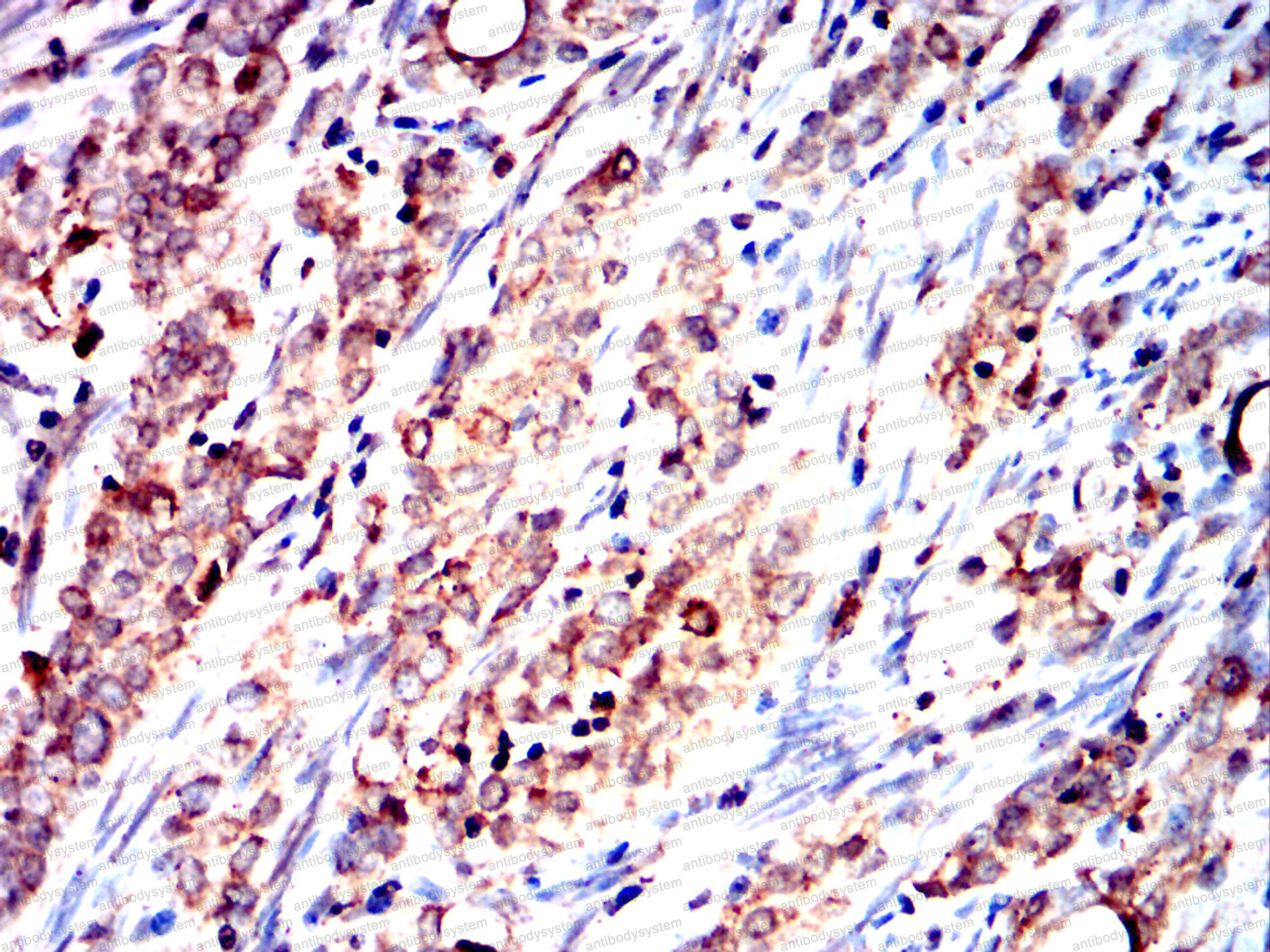 Валидация AntibodySystem RHD38803 (1549)