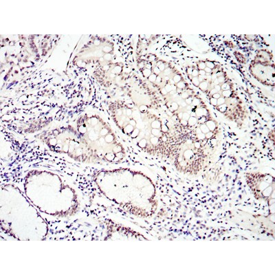 Валидация Affinity BF1003 - 5405