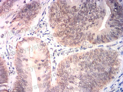 Валидация AntibodySystem RHN97701