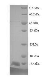 SDS-PAGE