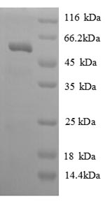 SDS-PAGE