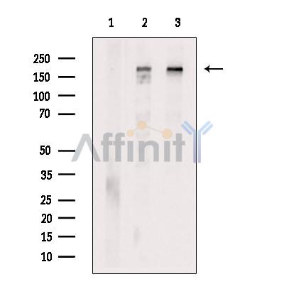 Валидация Affinity DF13215 - 8228