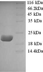 SDS-PAGE