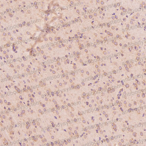 Валидация AntibodySystem RHD75201 (1797)