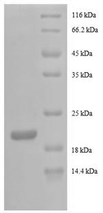 SDS-PAGE