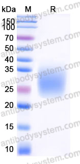 EHJ75002, SDS-PAGE