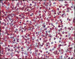 Валидация AntibodySystem RHE37706