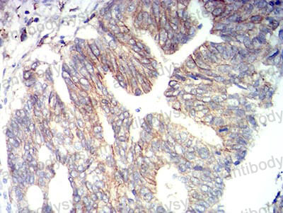 Валидация AntibodySystem RHG64006