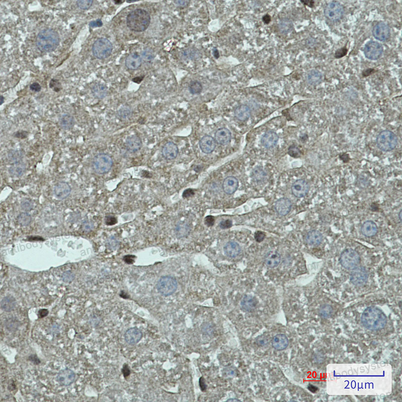 Валидация AntibodySystem RMG42701