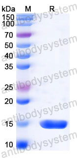 Валидация SDS-PAGE - AntibodySystem RMD30401