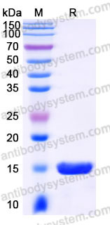 EHC06902, SDS-PAGE