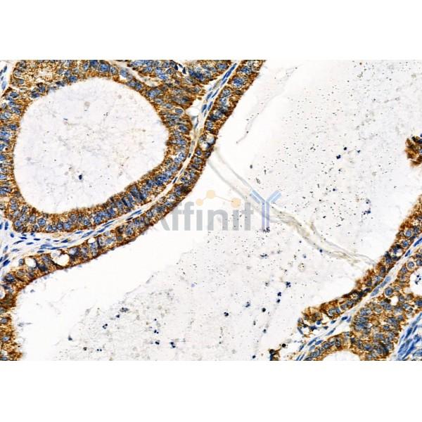 Валидация Affinity DF9403 - 21951