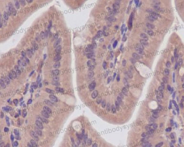 Валидация AntibodySystem RHN59801