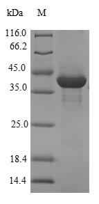 SDS-PAGE