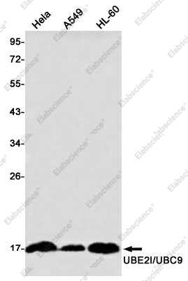 Вестерн-блоттинг, UBE2I/UBC9, клетки HeLa, A549, HL-60