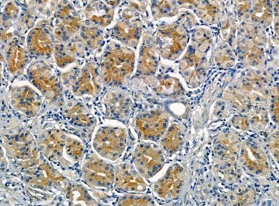 Валидация Affinity DF14184 - 9996