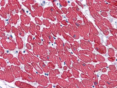 Валидация AntibodySystem RHC34502