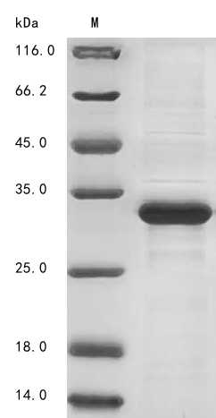 SDS-PAGE
