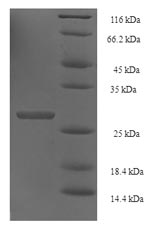 SDS-PAGE