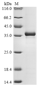 SDS-PAGE