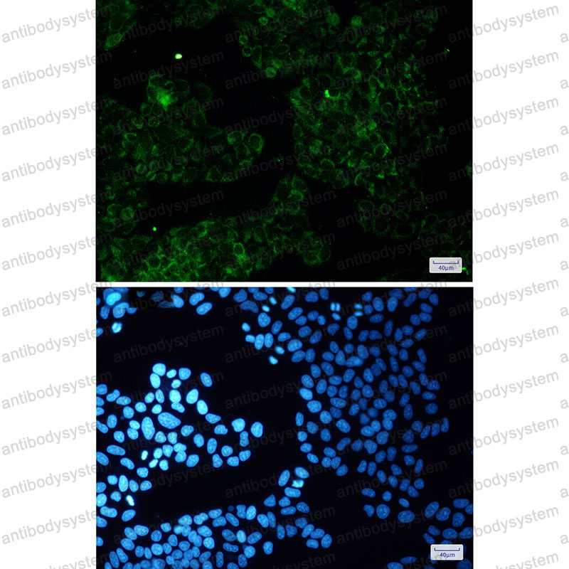 Валидация IF - AntibodySystem RHE65401