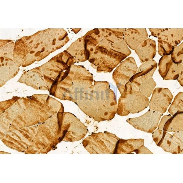 Валидация Affinity DF12110 - 6241