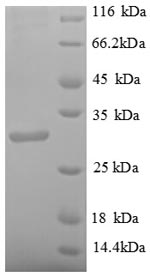 SDS-PAGE