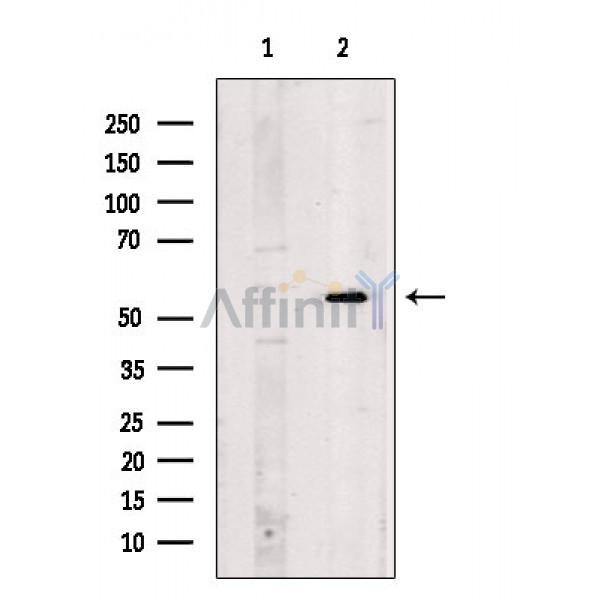 Валидация Affinity DF8157 - 20006