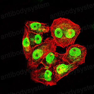 Валидация IF - AntibodySystem RHD66502