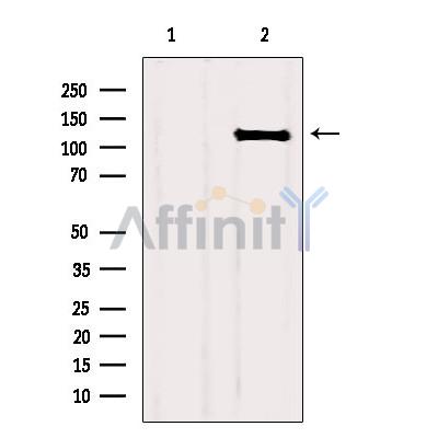 Валидация Affinity AF6156 - 3371