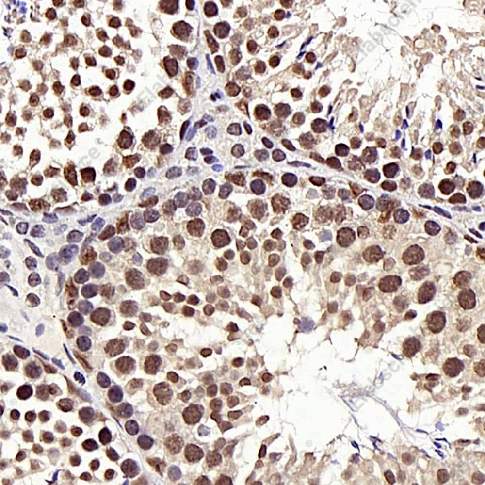 Иммуногистохимия, HDAC1, ткань семенника мыши