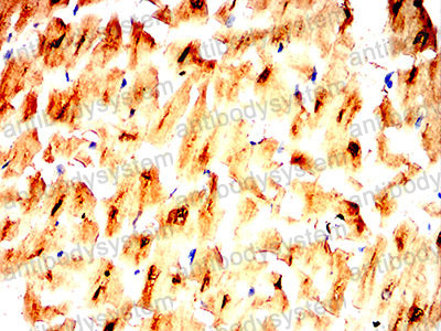 Валидация AntibodySystem RHE44901