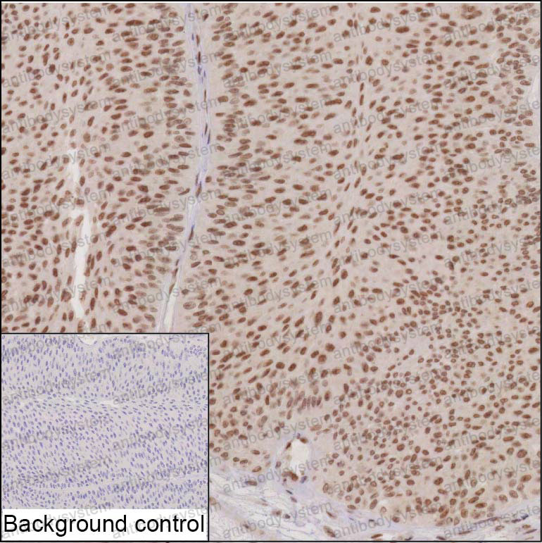 Валидация AntibodySystem RHN31503