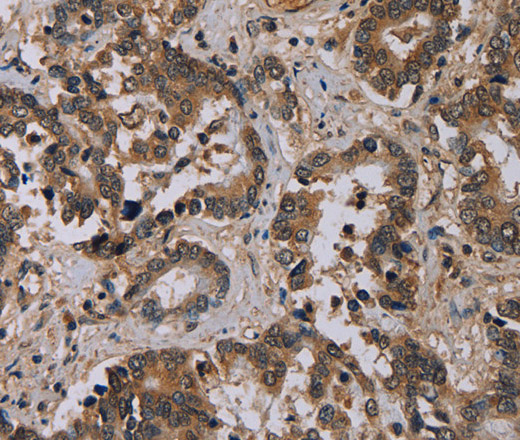 Валидация Elabscience E-AB-11318