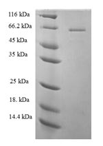 SDS-PAGE
