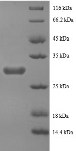 SDS-PAGE