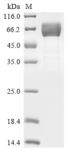 SDS-PAGE