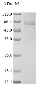 SDS-PAGE