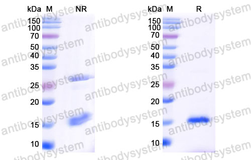 Валидация SDS-PAGE - AntibodySystem RHC90701