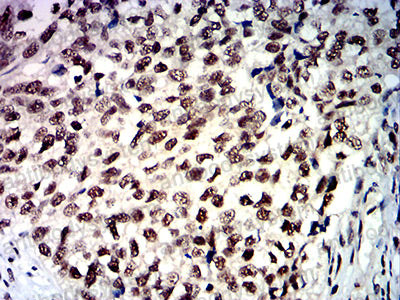 Валидация AntibodySystem RHG58202