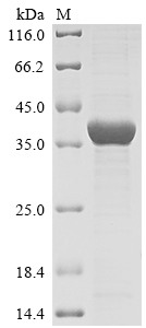 SDS-PAGE