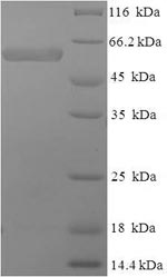 SDS-PAGE
