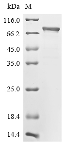 SDS-PAGE