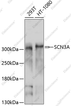 Вестерн-блоттинг, SCN3A, различные клеточные линии