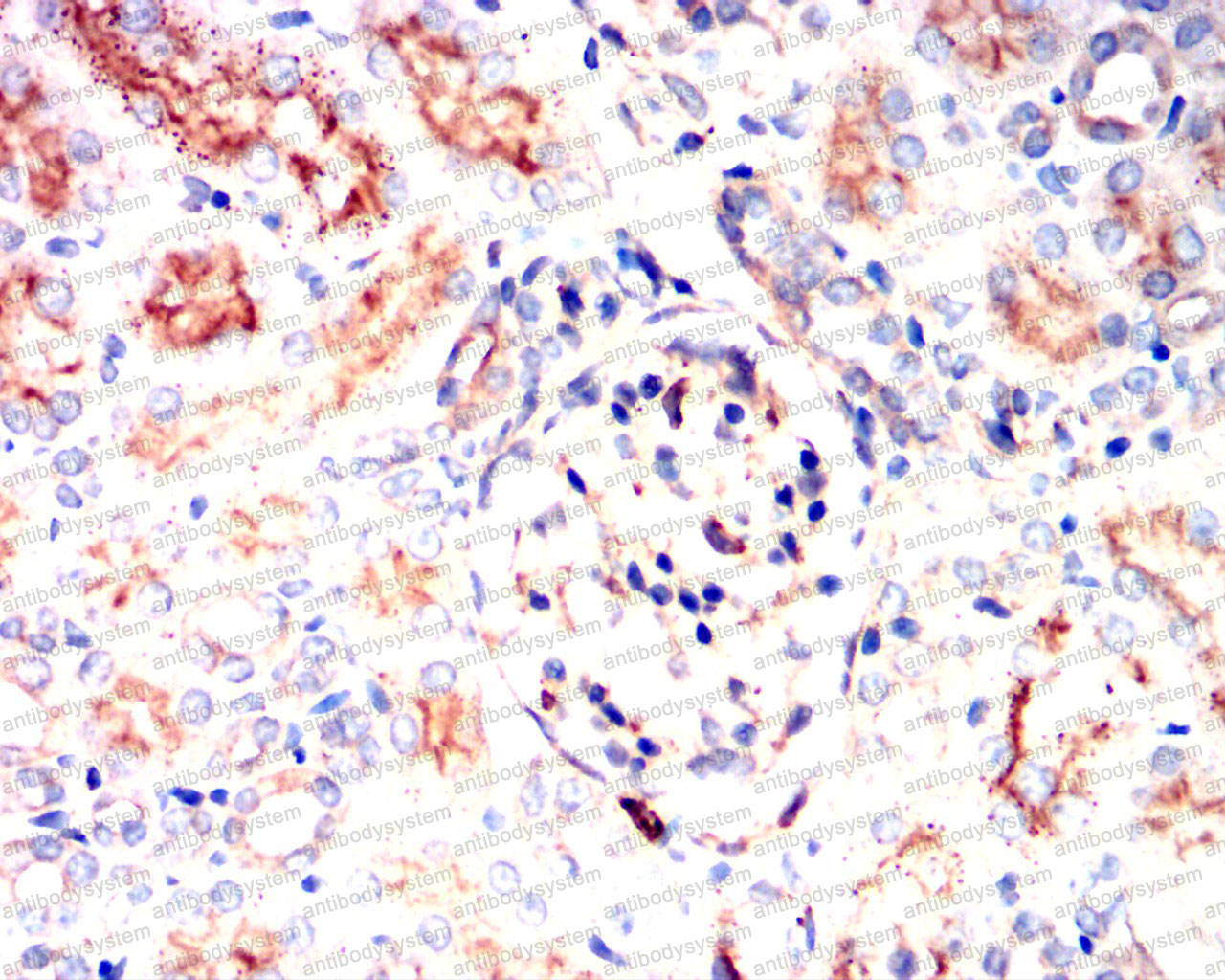 Валидация AntibodySystem RHE35201