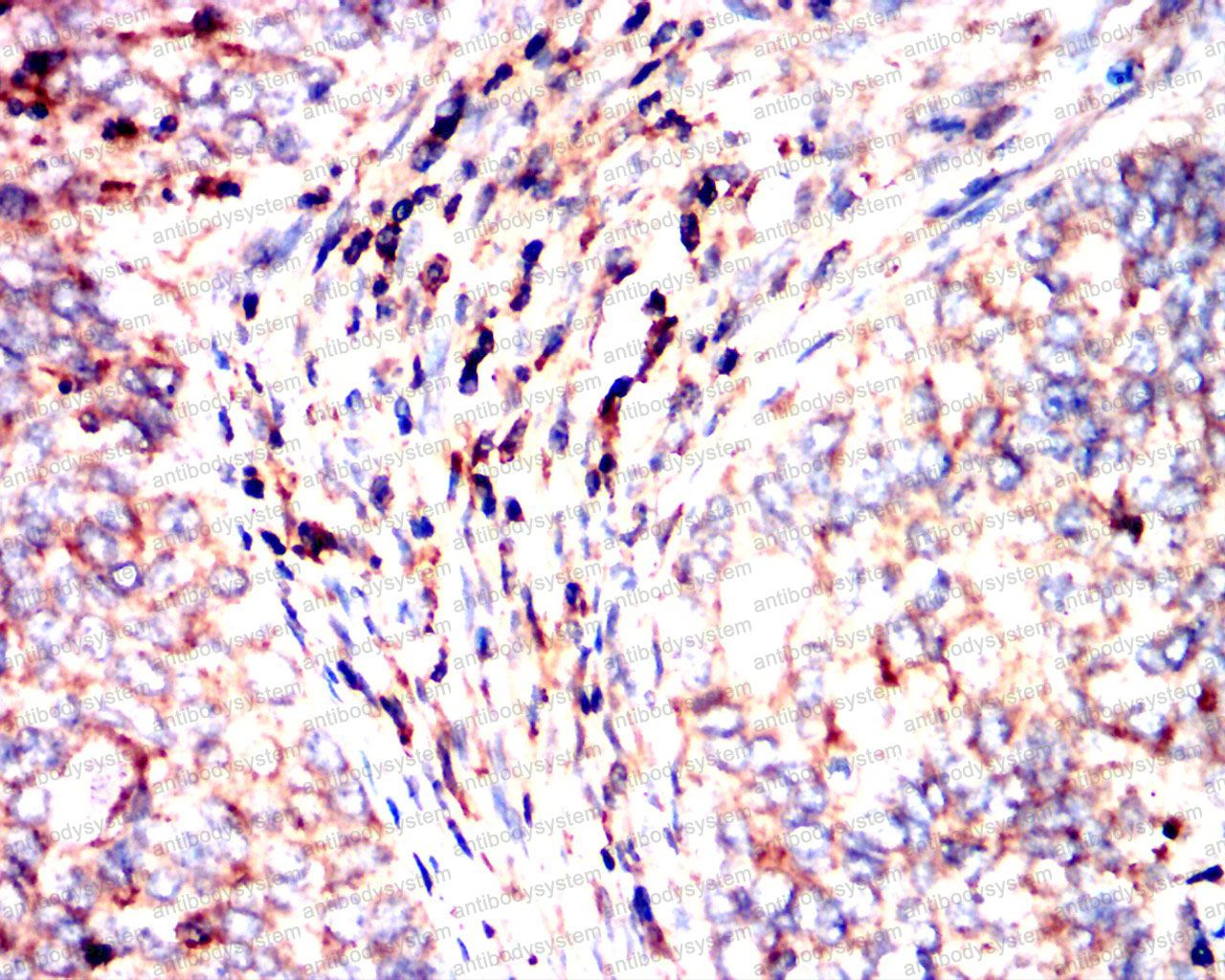 Валидация AntibodySystem RHE35201 (2097)