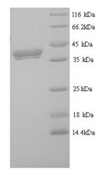 SDS-PAGE