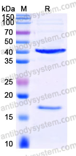 EHJ49901, SDS-PAGE